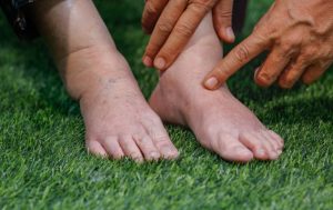 Como diminuir a retenção de líquidos com a alimentação