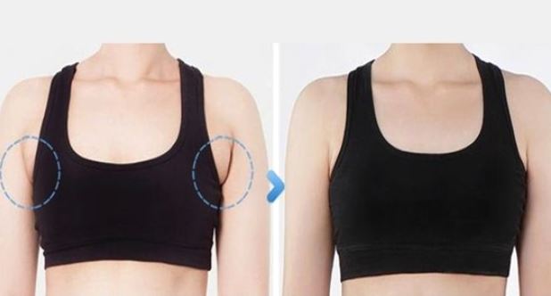 Comparativo de uma mulher com e sem gordura nas axilas