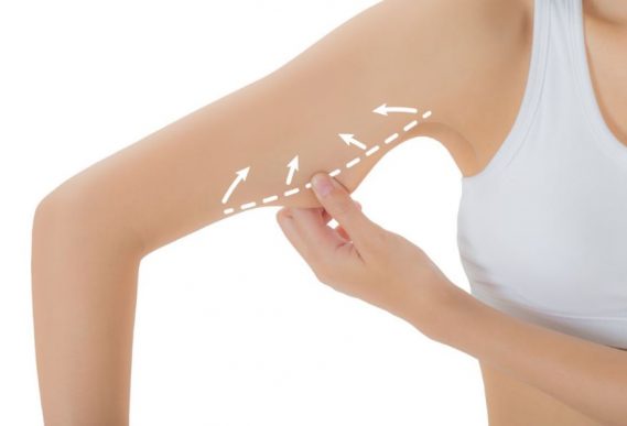 Como podemos reduzir a flacidez do nosso corpo?