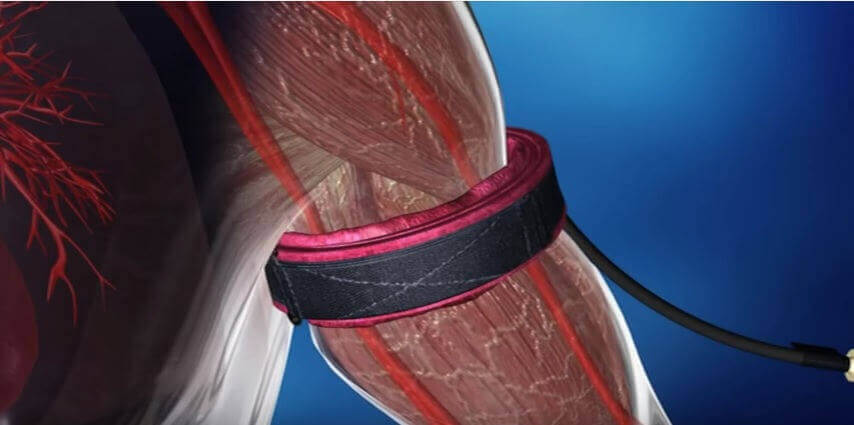 um treinamento oclusivo