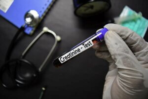 A creatinina é prejudicial à saúde?