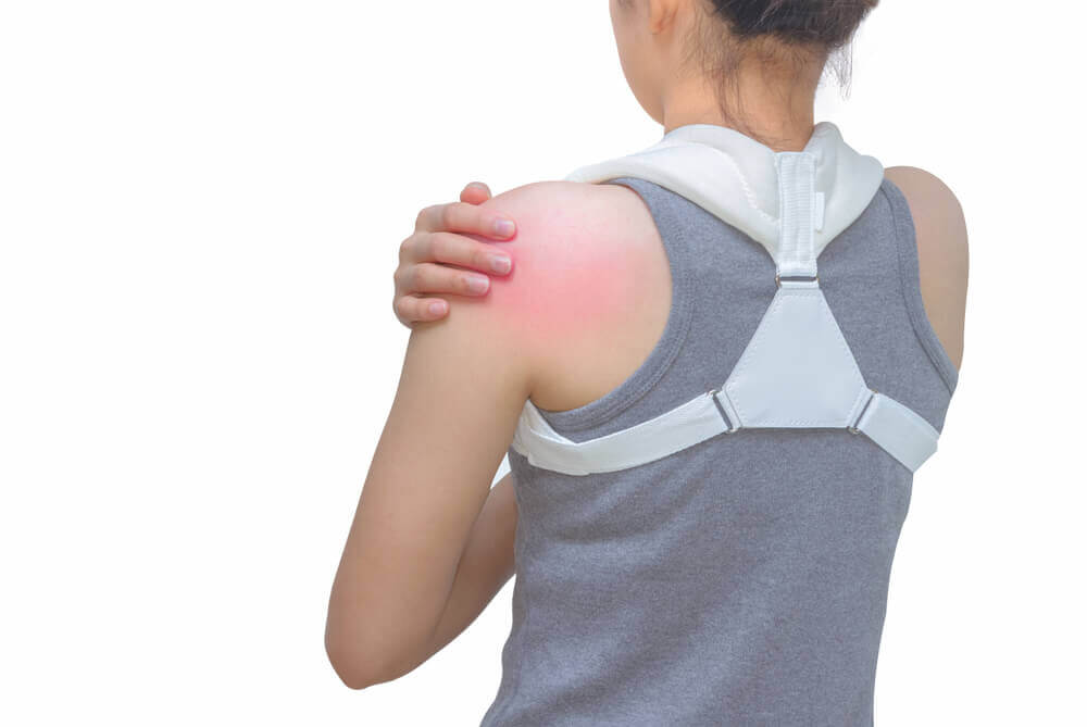 Fratura de clavícula: é possível prevenir?