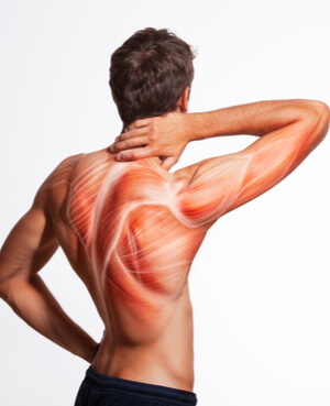 Musculação